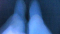 X Rays