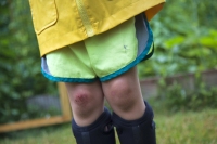 A Scrape