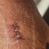 It's a Stitch Up