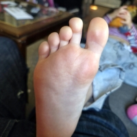 Spot the Owie