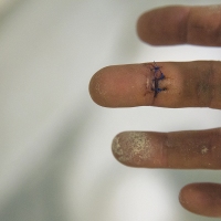 Stitched Up