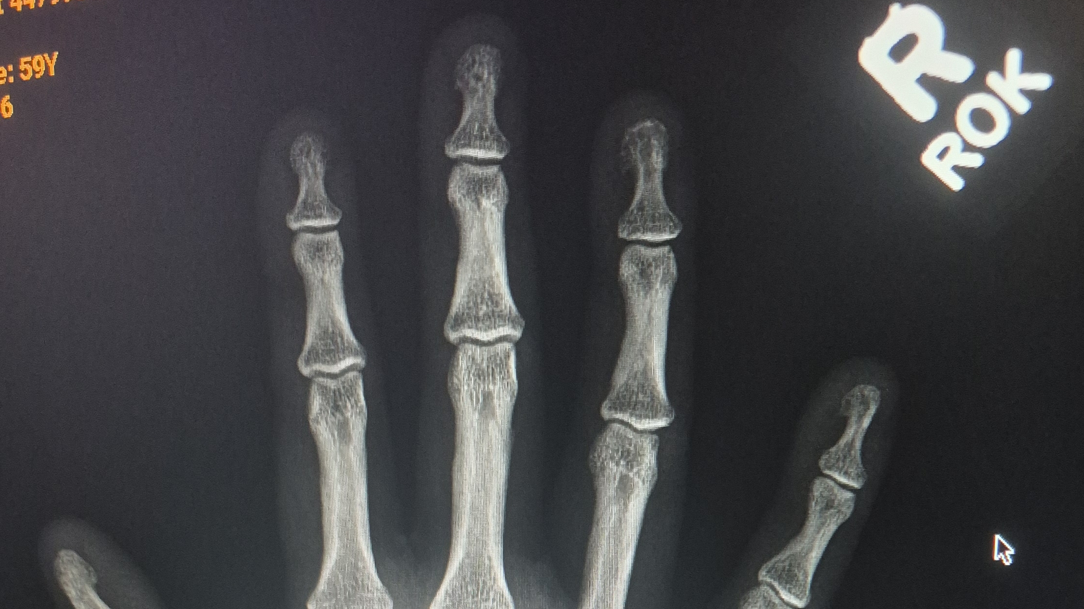 Them Bones